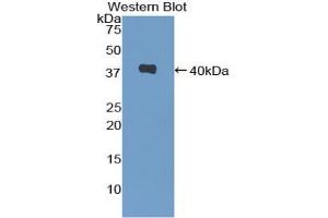 Western blot analysis of the recombinant protein. (CXCL2 antibody  (AA 28-100))