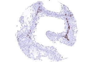Strong cytoplasmic StAR immunostaining of Leydig cells (Recombinant STAR antibody)