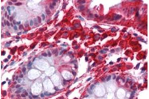 Human Colon: Formalin-Fixed, Paraffin-Embedded (FFPE) (Stathmin 1 antibody  (AA 85-119))