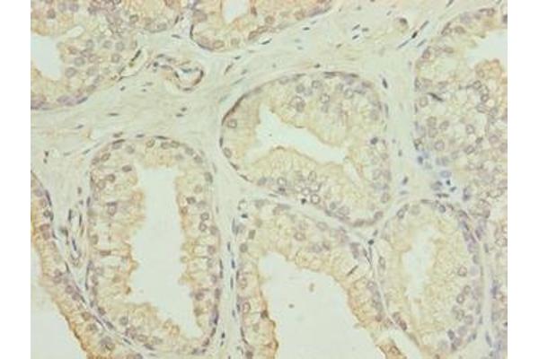 GID8/C20orf11 antibody  (AA 1-228)