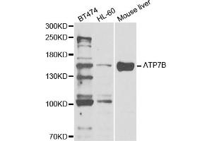 Western blot analysis of extracts of various cell lines, using ATP7B antibody (ABIN5973316) at 1/1000 dilution. (ATP7B antibody)