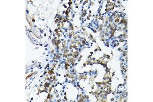 Immunohistochemistry (IHC) image for anti-Protein Arginine Methyltransferase 5 (PRMT5) (AA 40-140) antibody (ABIN3022066)