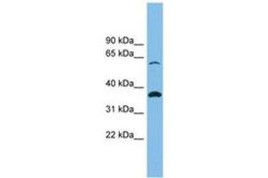 Image no. 1 for anti-Solute Carrier Family 25 (Mitochondrial Carrier, Adenine Nucleotide Translocator), Member 4 (SLC25A4) (AA 35-84) antibody (ABIN6744751) (SLC25A4 antibody  (AA 35-84))