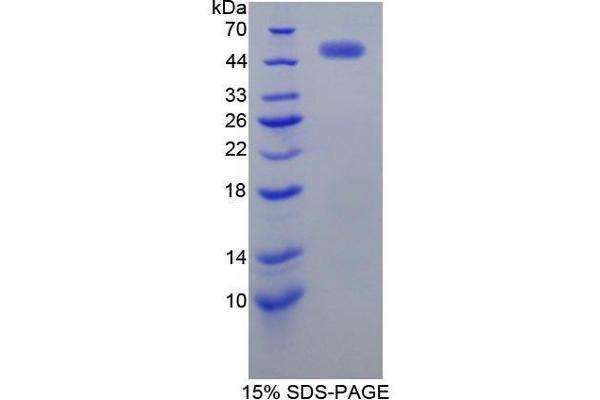 EGFR2 Protein