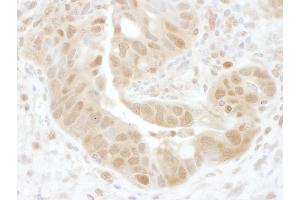 Immunohistochemistry (IHC) image for anti-Proteasome (Prosome, Macropain) 26S Subunit, Non-ATPase, 7 (PSMD7) (AA 150-200) antibody (ABIN7454967)