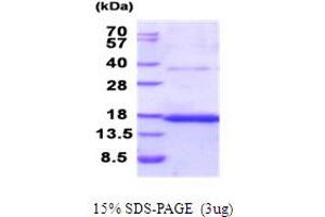 SDS-PAGE (SDS) image for Tetraspanin 26 (TSPAN26) (AA 112-241) protein (His tag) (ABIN5853972) (CD37 Protein (AA 112-241) (His tag))
