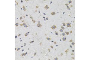 Immunohistochemistry of paraffin-embedded mouse brain using SIGMAR1 antibody (ABIN5973191) (40x lens). (SIGMAR1 antibody)