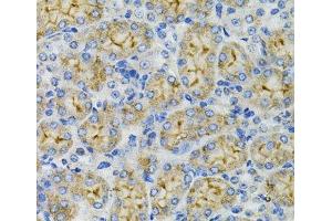 Immunohistochemistry of paraffin-embedded Mouse kidney using DEFB132 Polyclonal Antibody at dilution of 1:100 (40x lens).