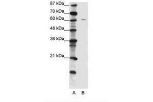 Image no. 1 for anti-Zinc Finger Protein 268A (ZNF286A) (C-Term) antibody (ABIN202711) (ZNF286A antibody  (C-Term))