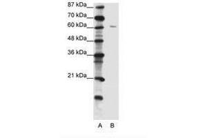 ZNF286A antibody  (C-Term)