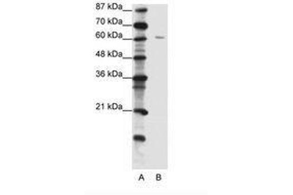 ZNF286A antibody  (C-Term)