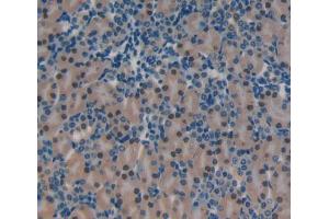 Used in DAB staining on fromalin fixed paraffin- embedded Kidney tissue (YAF2 antibody  (AA 1-179))
