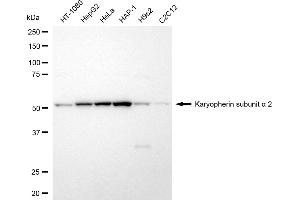 Western blotting analysis using karyopherin subunit alpha 2 antibody (ABIN7800945).