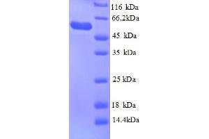 SDS-PAGE (SDS) image for Glycerol Kinase (GK) (AA 2-502) protein (His tag) (ABIN5713168) (Glycerol Kinase Protein (GK) (AA 2-502) (His tag))