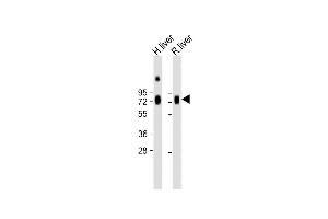 All lanes : Anti-HPX Antibody (Center) at 1:2000 dilution Lane 1: Human liver lysate Lane 2: Rat liver lysate Lysates/proteins at 20 μg per lane. (Hemopexin antibody  (AA 200-227))