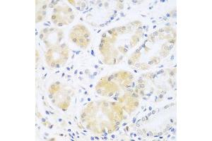 Immunohistochemistry of paraffin-embedded human stomach using C5 antibody at dilution of 1:100 (40x lens).