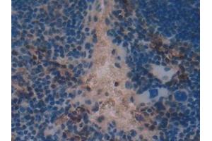 Immunohistochemistry (IHC) image for anti-Transcription Factor A, Mitochondrial (TFAM) (AA 43-243) antibody (ABIN7438793)