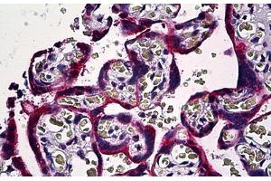 Human Placenta: Formalin-Fixed, Paraffin-Embedded (FFPE) (SMAD3 antibody  (AA 120-222))