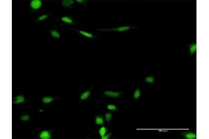 Immunofluorescence of purified MaxPab antibody to SMARCB1 on HeLa cell. (SMARCB1 antibody  (AA 1-385))