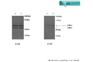 SCARB1 antibody  (AA 21-100)