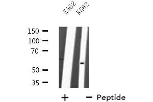 Western blot analysis of extracts from K562 cells, using TRAF2 antibody.