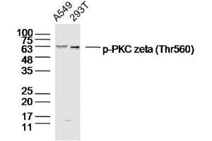 Lane 1: A549 Lane 2: 293T lysates probed with PKC zeta (Thr560) Polyclonal Antibody, Unconjugated  at 1:300 dilution and 4˚C overnight incubation. (PKC zeta antibody  (pThr560))