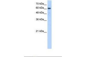 Image no. 1 for anti-ADAM Metallopeptidase Domain 30 (ADAM30) (AA 81-130) antibody (ABIN321644) (ADAM30 antibody  (AA 81-130))