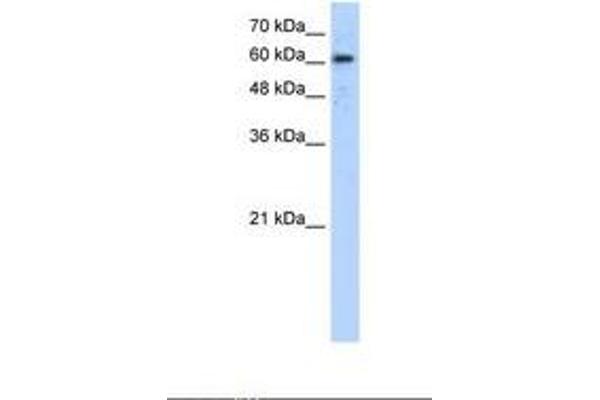 ADAM30 antibody  (AA 81-130)