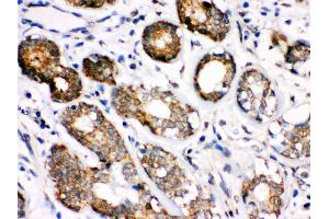 Immunohistochemistry (Paraffin-embedded Sections) (IHC (p)) image for anti-Heat Shock 70kDa Protein 8 (HSPA8) (AA 520-614) antibody (ABIN3043852) (Hsc70 antibody  (AA 520-614))