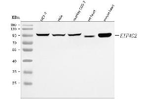 Western blot analysis of P97/DAP5/EIF4G2 using anti-P97/DAP5/EIF4G2 antibody (ABIN7600770).