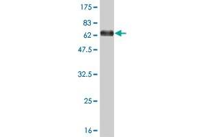 Western Blot detection against Immunogen (67. (MEIS2 antibody  (AA 1-381))