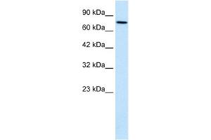 WB Suggested Anti-WHSC1 Antibody Titration:  0.