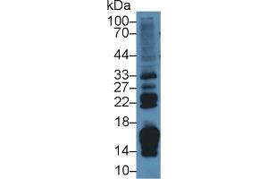 Western Blot; Sample: Rat Small intestine lysate; Primary Ab: 2µg/ml Rabbit Anti-Rat RBP2 Antibody Second Ab: 0. (RBP2 antibody  (AA 1-134))