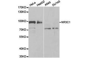Western Blotting (WB) image for anti-Nuclear Receptor Subfamily 3, Group C, Member 1 (Glucocorticoid Receptor) (NR3C1) antibody (ABIN1873953) (Glucocorticoid Receptor antibody)