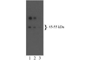 Western blot analysis for 5-HT2BR (second panel). (Serotonin Receptor 2B antibody  (AA 1-58))