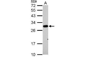 Prohibitin antibody