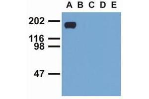 Western Blotting (WB) image for anti-Epidermal Growth Factor Receptor (EGFR) (pTyr1016) antibody (ABIN400878) (EGFR antibody  (pTyr1016))