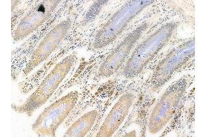 ABIN6261965 and ABIN6278698 at 1/100 staining human normal colon tissue by IHC-P. (GLI3 antibody  (Internal Region))