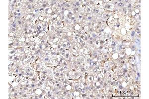IHC analysis of RBP1 using anti-RBP1 antibody (ABIN7599586). (RBP1 antibody  (AA 10-135))