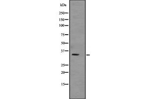 Western blot analysis of TNNT3 expression in Human skeletal muscle lysate; Mouse skeletal muscle lysate; Rat skeletal muscle lysate,The lane on the left is treated with the antigen-specific peptide. (TNNT3 antibody  (C-Term))