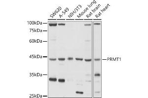 Western blot analysis of extracts of various cell lines, using PRMT1 antibody (ABIN3021311, ABIN3021312, ABIN3021313 and ABIN6214838) at 1:1000 dilution. (PRMT1 antibody  (AA 20-353))