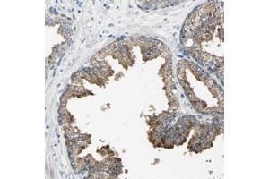 Immunohistochemical staining (Formalin-fixed paraffin-embedded sections) of human prostate with RASD2 polyclonal antibody  shows moderate cytoplasmic positivity in glandular cells. (RASD2 antibody)