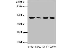 Western Blot All lanes: CBWD2 antibody at 6 μg/mL Lane 1: Mouse heart tissue Lane 2: Mouse liver tissue Lane 3: Mouse lung tissue Lane 4: Hela whole cell lysate Secondary Goat polyclonal to rabbit IgG at 1/10000 dilution Predicted band size: 45 kDa Observed band size: 45 kDa (CBWD2 antibody  (AA 96-395))