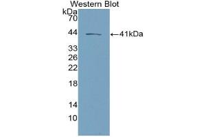 Detection of Recombinant NKB, Mouse using Polyclonal Antibody to Neurokinin B (NKB) (Tachykinin 3 antibody  (AA 29-101))