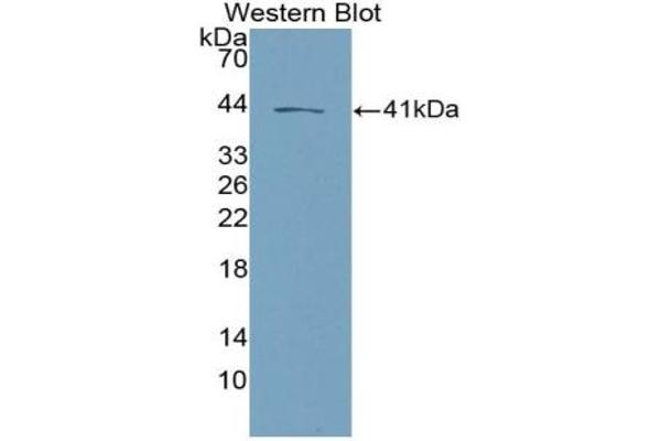 Tachykinin 3 anticorps  (AA 29-101)