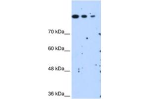 Western Blotting (WB) image for anti-SET Domain Containing 2 (SETD2) antibody (ABIN2463084) (SETD2 antibody)