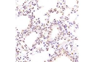 Immunohistochemistry analysis of paraffin-embedded mouse lung using,NCAPG2 (ABIN7074856) at dilution of 1: 1600 (NCAPG2 antibody)