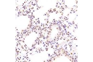 Immunohistochemistry analysis of paraffin-embedded mouse lung using,NCAPG2 (ABIN7074856) at dilution of 1: 1600