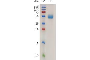 Mouse D Protein, hFc Tag on SDS-PAGE under reducing condition.