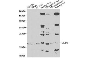 Western blot analysis of extracts of various cell lines, using CD59 antibody.